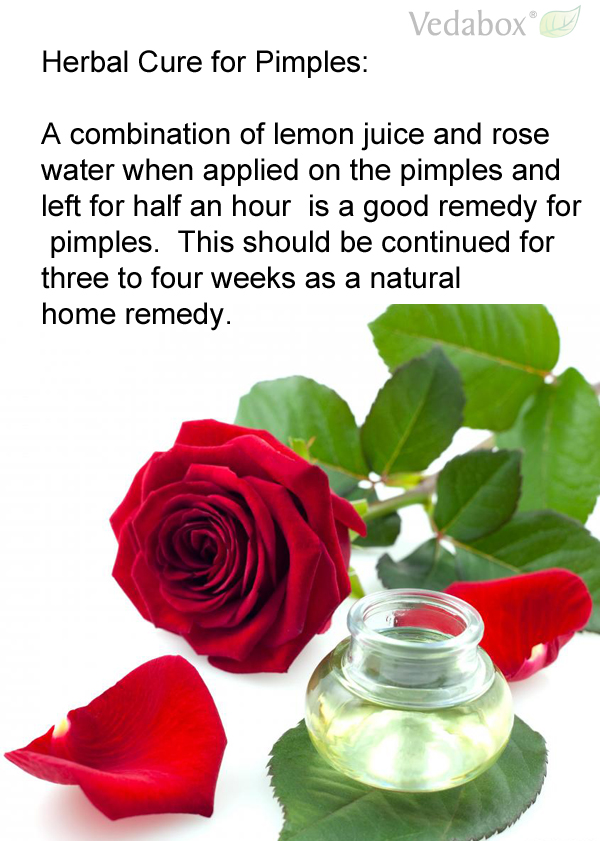 Herbal Cure for Pimples