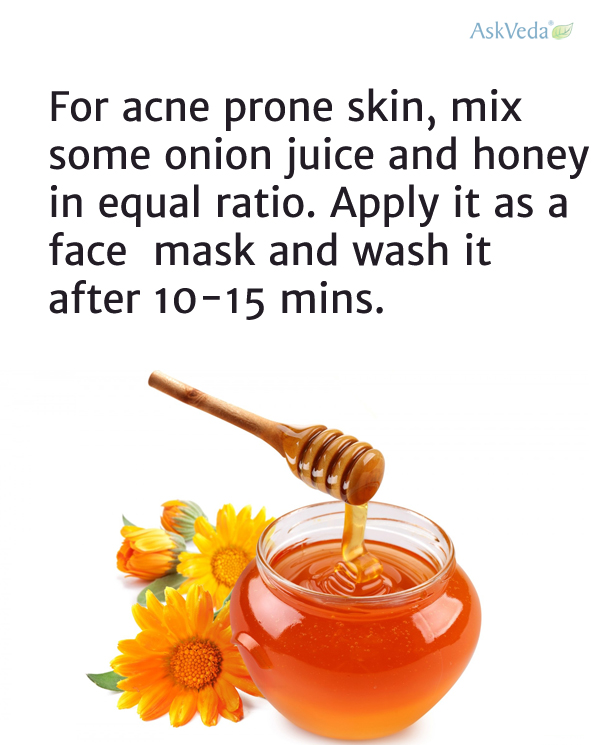 Acne home remedy: 